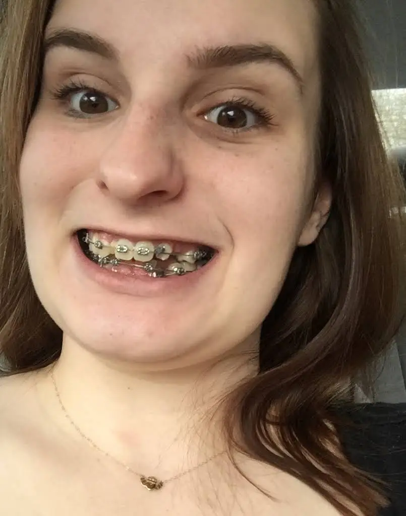Specialty Smiles Orthodontists