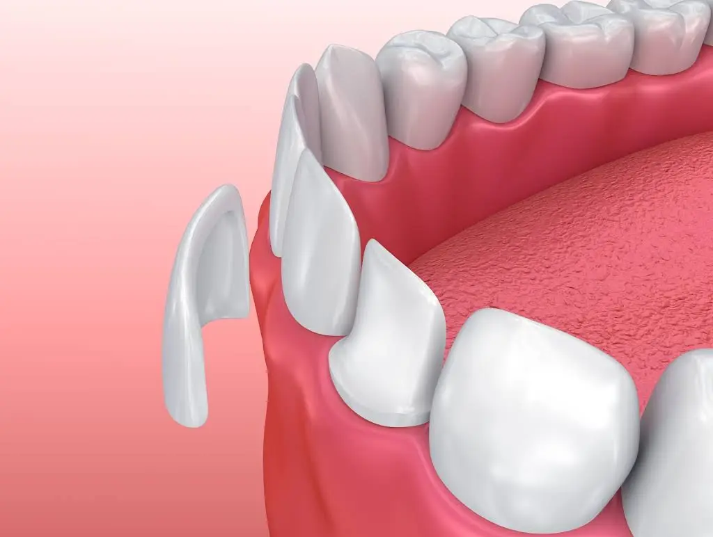 Perfect Smile and Implant Center
