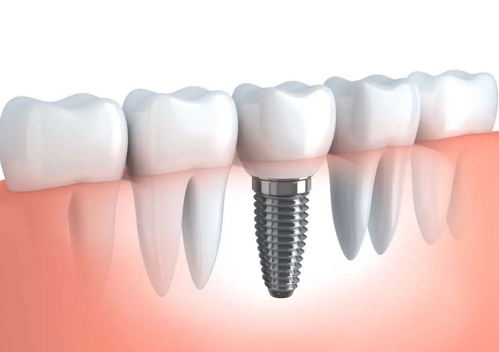 Bright Smiles by Dr. Vera Family and Cosmetic Dentistry