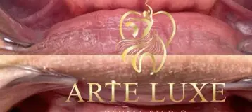 Arte Luxe Dental Studio