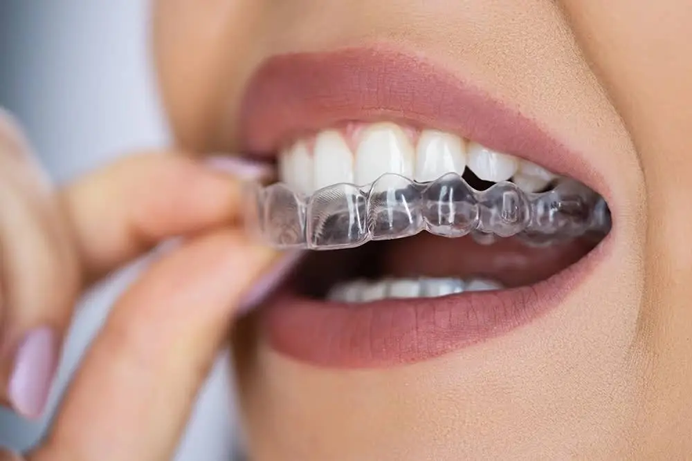 NextGen Dental & Orthodontics of Florida