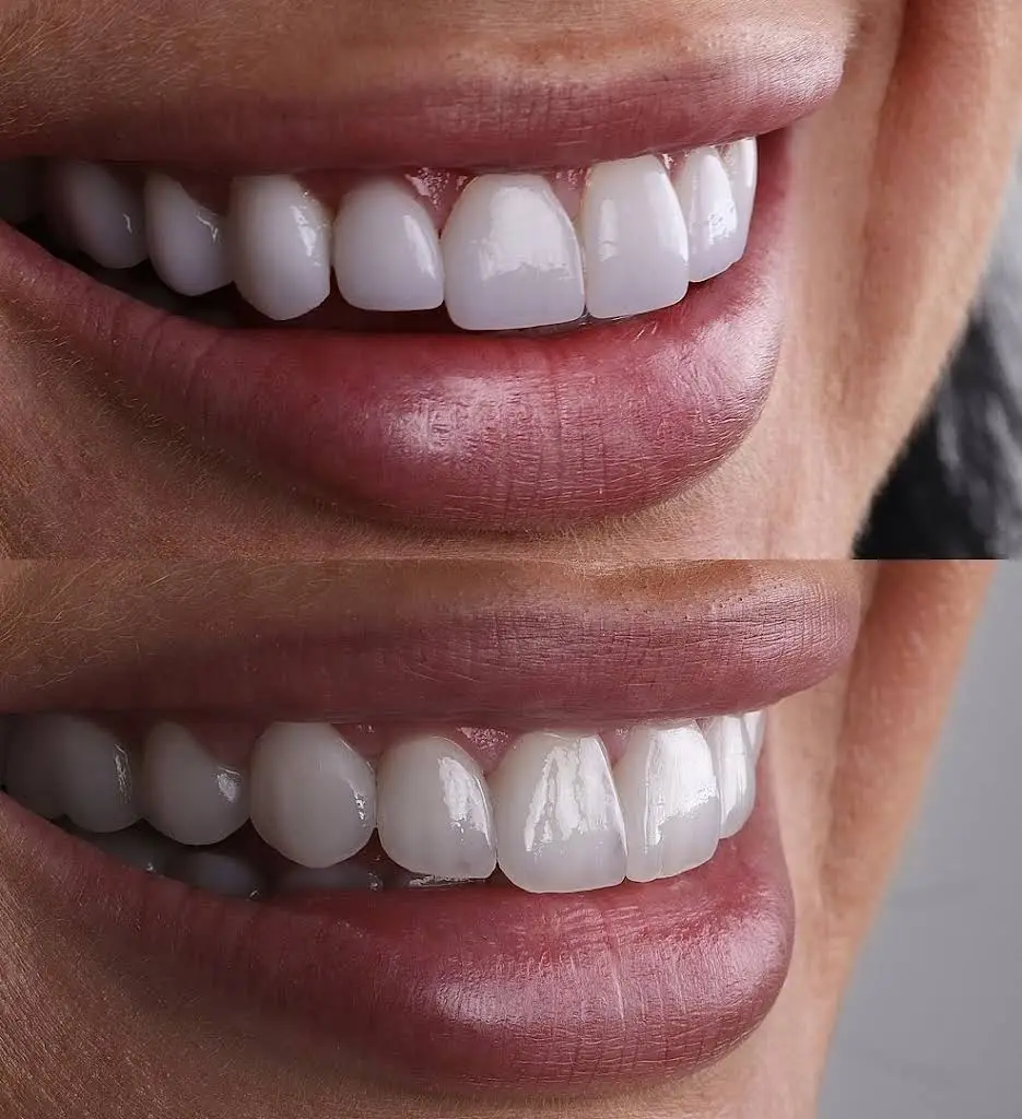 NextGen Dental & Orthodontics of Florida