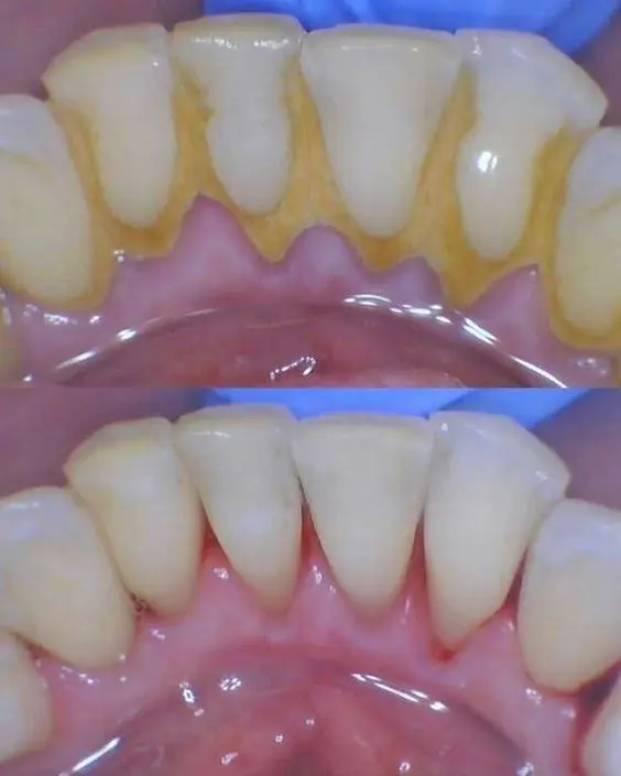 NextGen Dental & Orthodontics of Florida