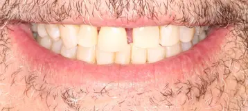 Dentalvana
