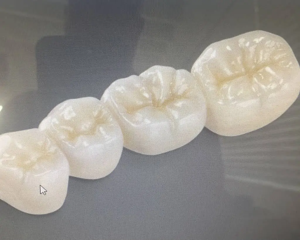 Beach Smile Family Dentistry