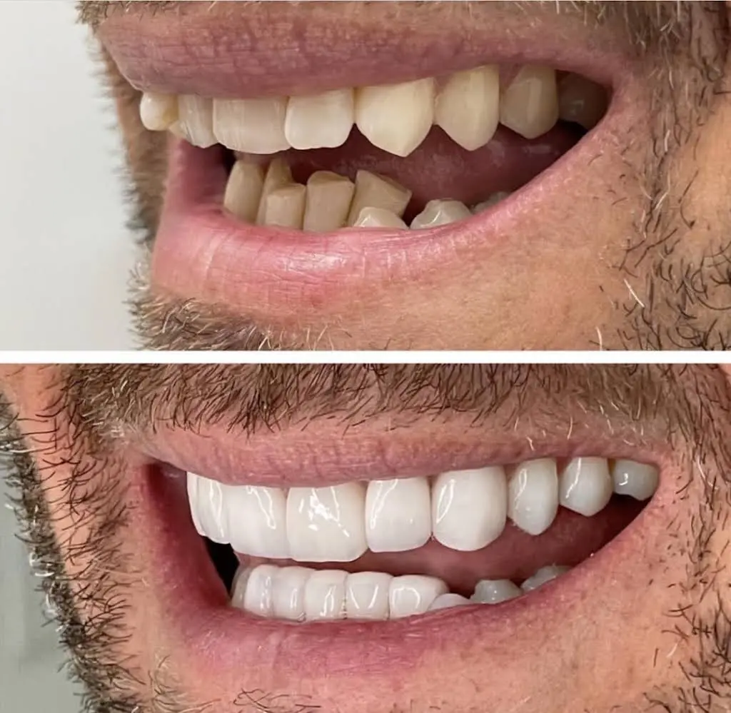 Sher Dental