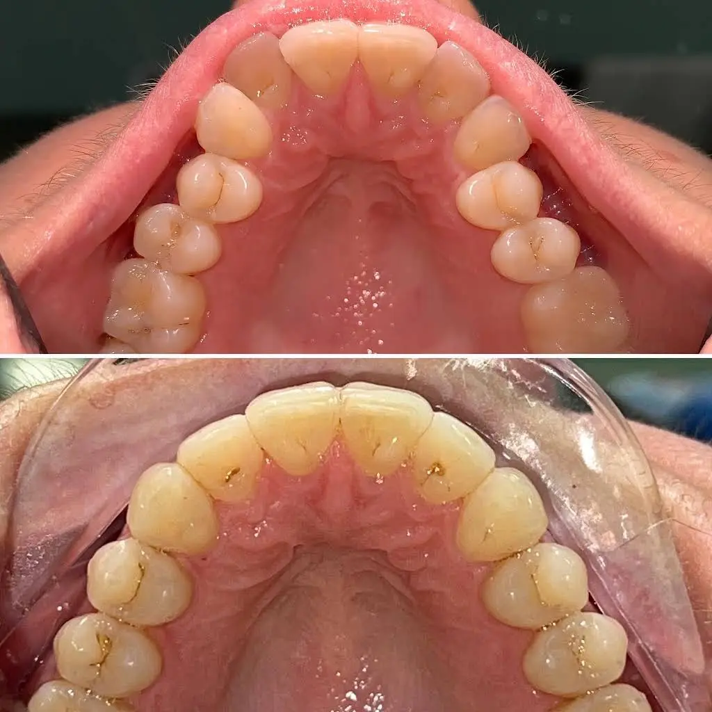 My Miami Lakes Dentist