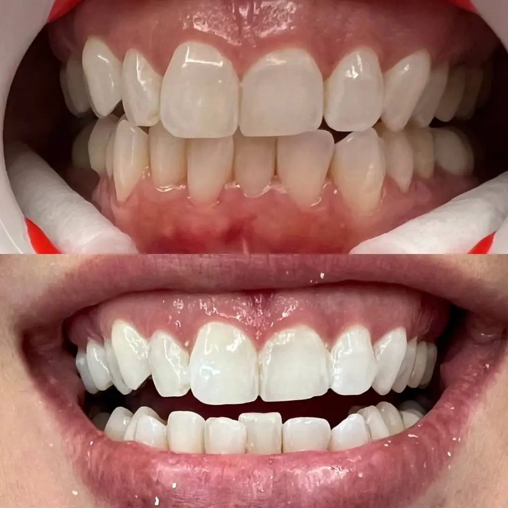 Llanos Dental Group