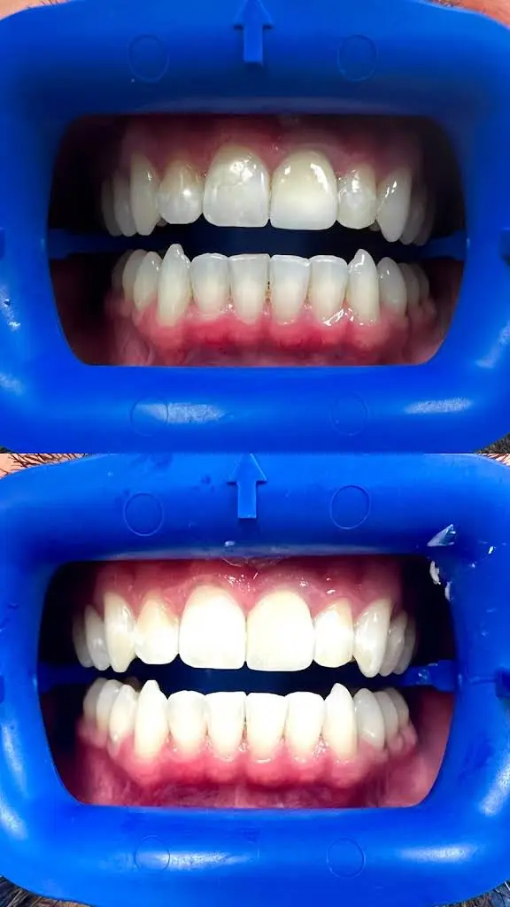 Llanos Dental Group