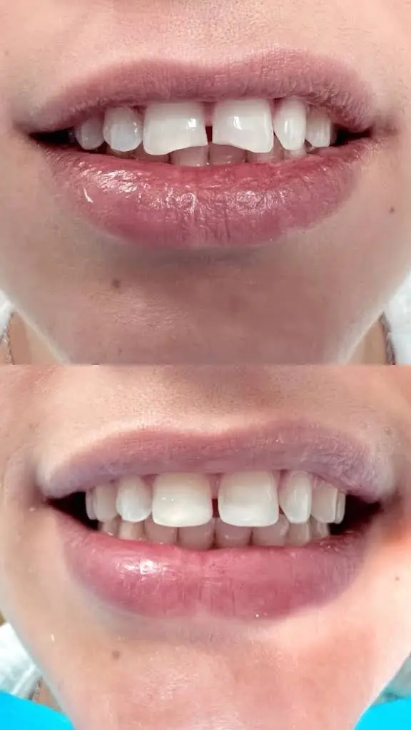 Llanos Dental Group