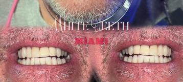 White Teeth Miami