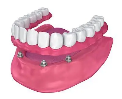 Fain Dental Arts of North Miami