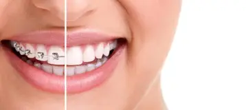 Miami Beach Orthodontics