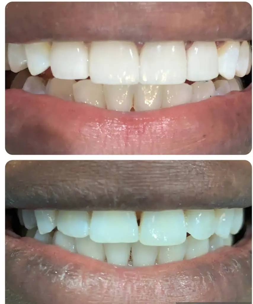 Dr. Patty Miami Cosmetic Dentistry