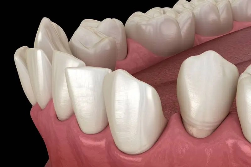 Dr. Patty Miami Cosmetic Dentistry