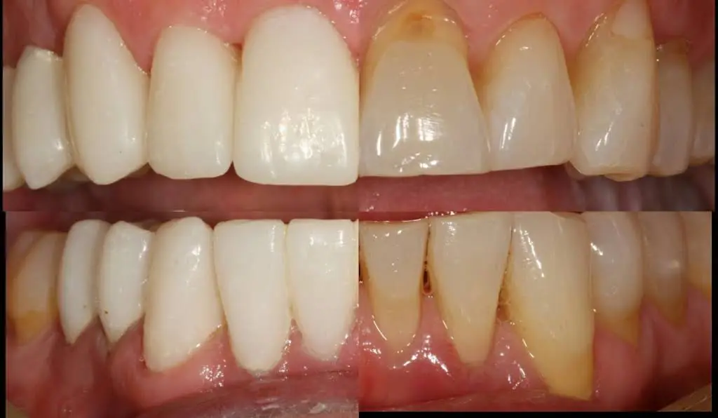 Biscayne Dental & Facial Aesthetics
