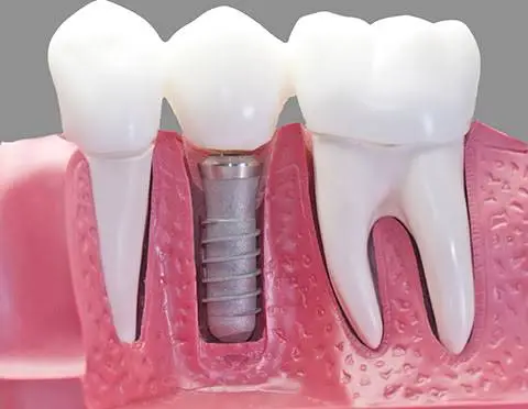 Center for Excellence in Dentistry