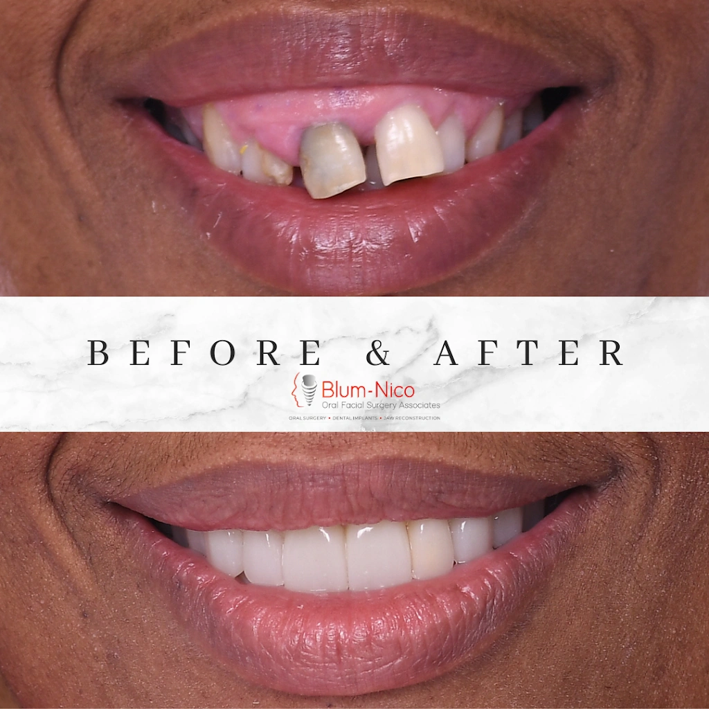 Blum-Nico Oral Surgery Associates