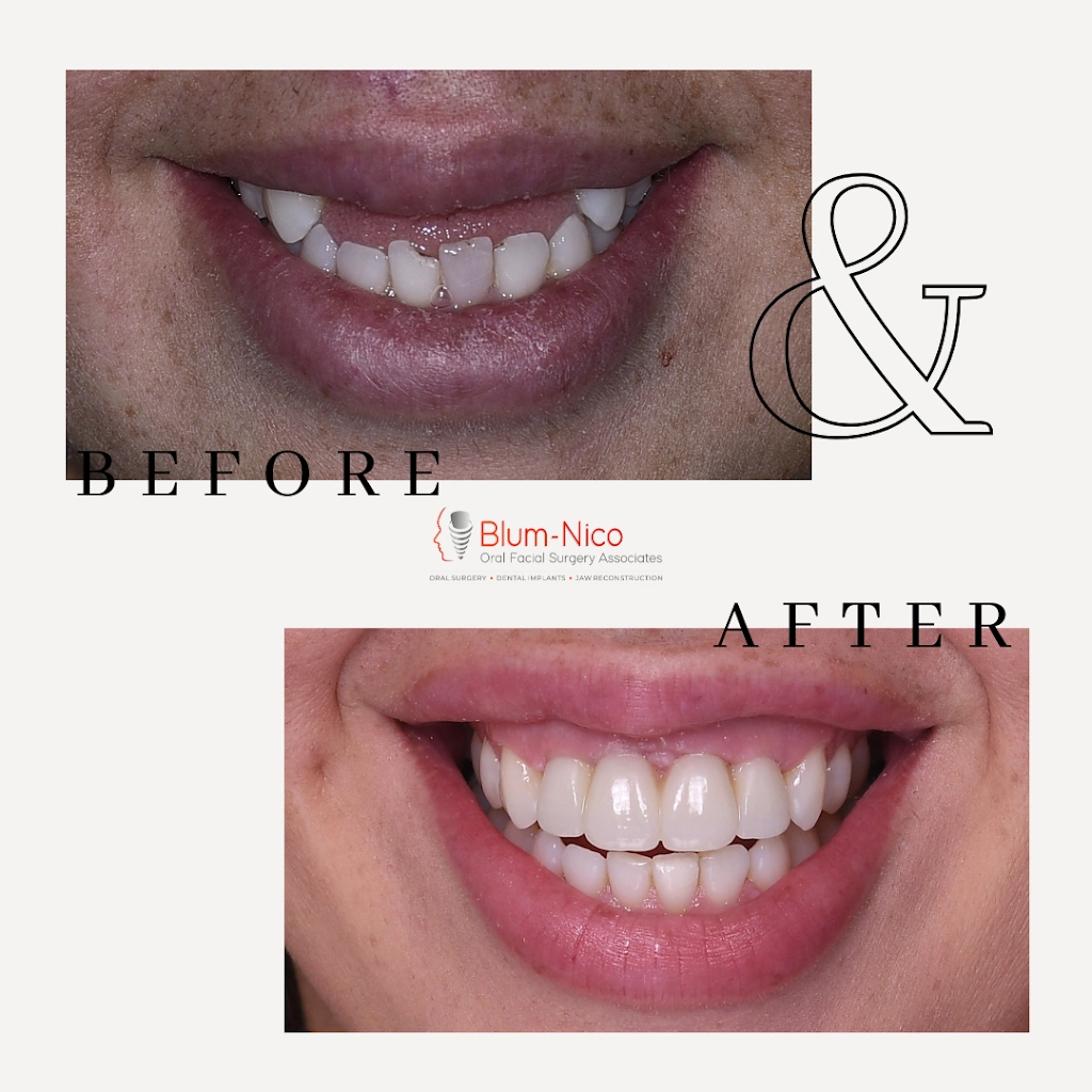 Blum-Nico Oral Surgery Associates