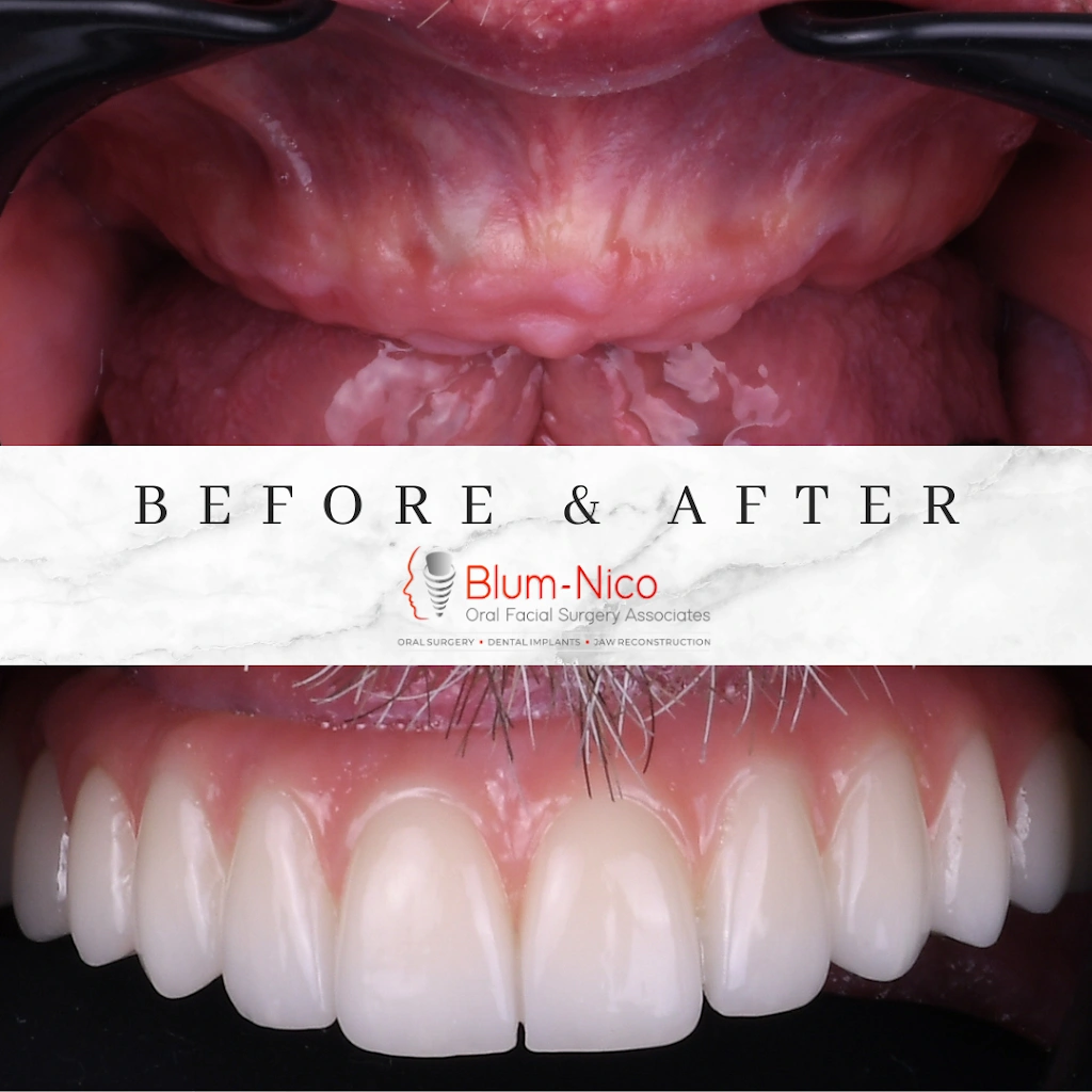 Blum-Nico Oral Surgery Associates