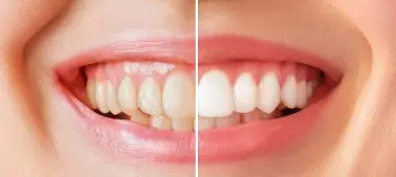 Precious Smiles Cosmetic Dentistry