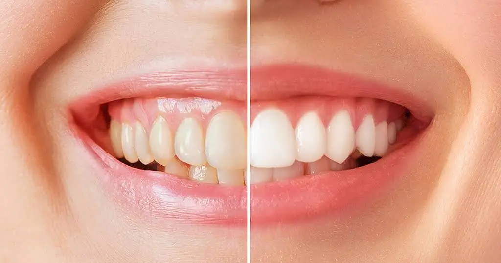 Precious Smiles Cosmetic Dentistry - Professional dental clinic exterior with modern facilities