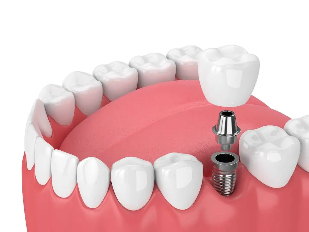 Precious Smiles Cosmetic Dentistry