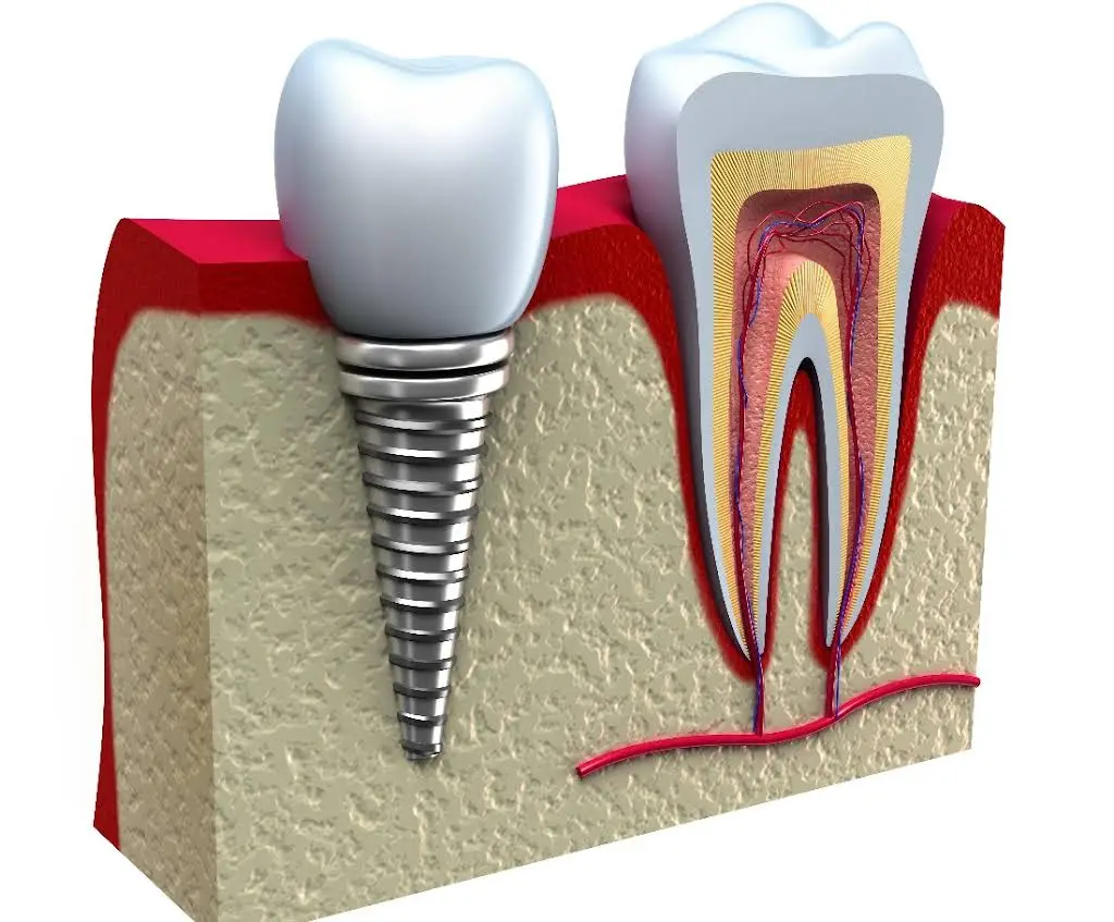 Precious Smiles Cosmetic Dentistry