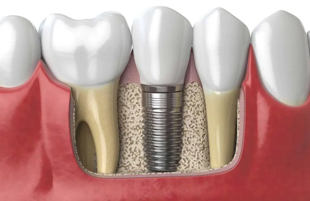 Precious Smiles Cosmetic Dentistry