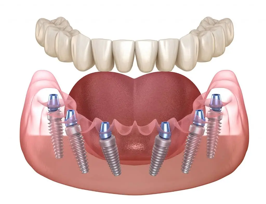 Dental Care of South Florida Inc.