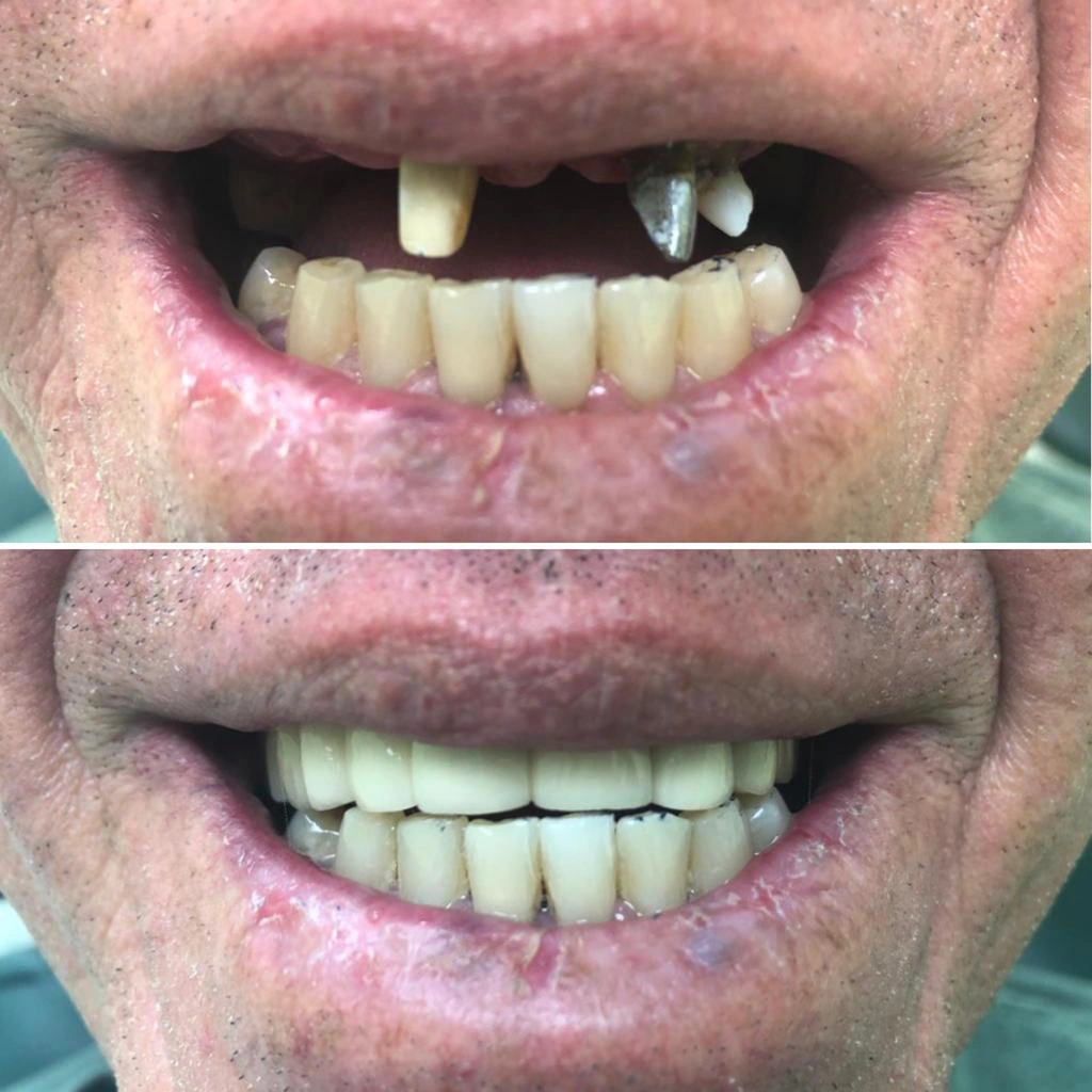 COLLAZO FAMILY DENTAL