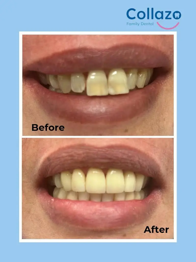 COLLAZO FAMILY DENTAL