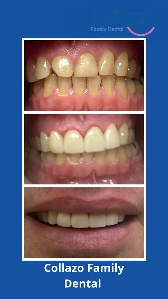 COLLAZO FAMILY DENTAL
