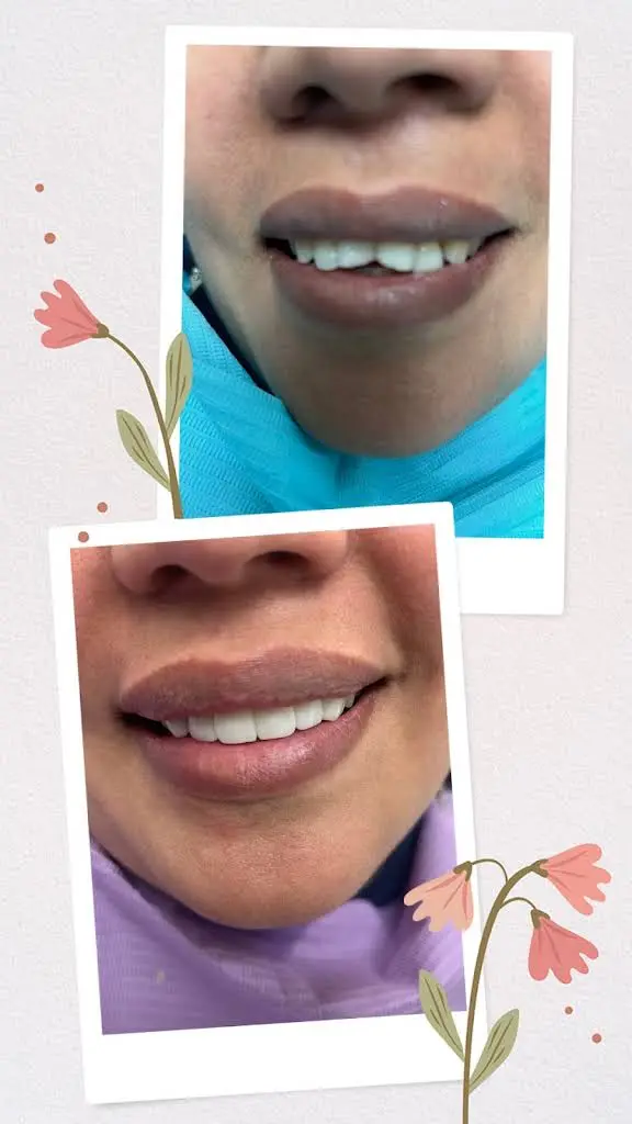 COLLAZO FAMILY DENTAL