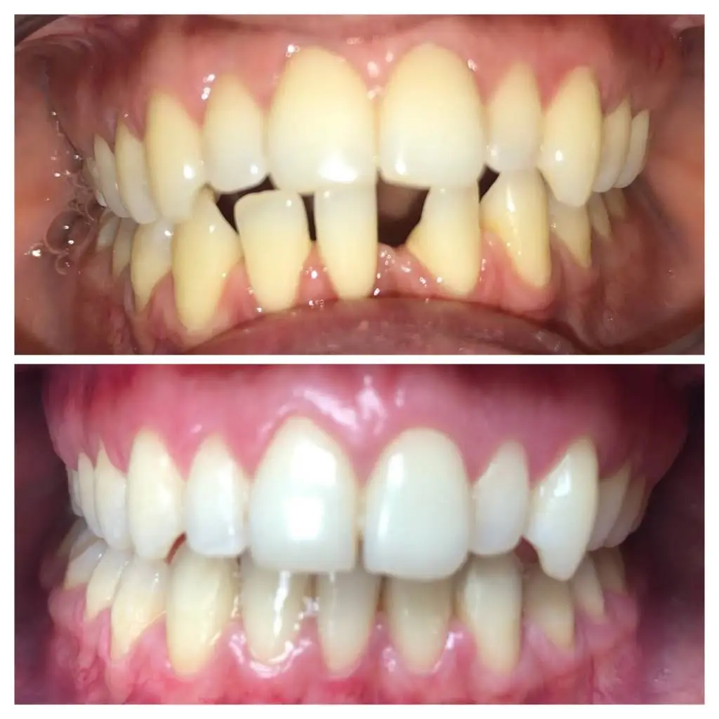 COLLAZO FAMILY DENTAL
