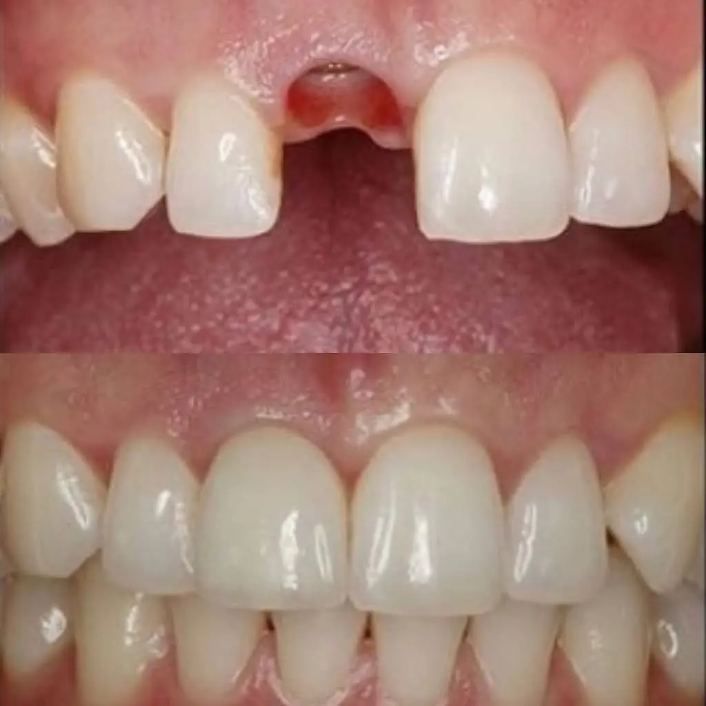Lizaso Family Dentistry