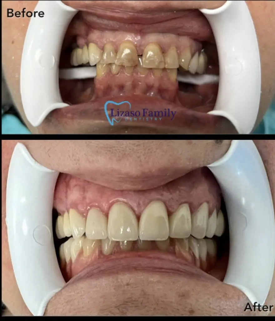 Lizaso Family Dentistry