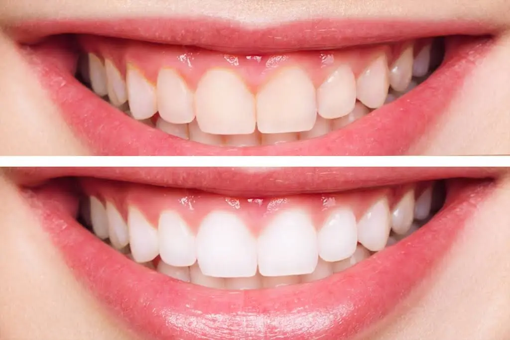 High Cosmetic Dentist