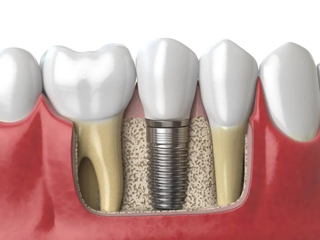 High Cosmetic Dentist