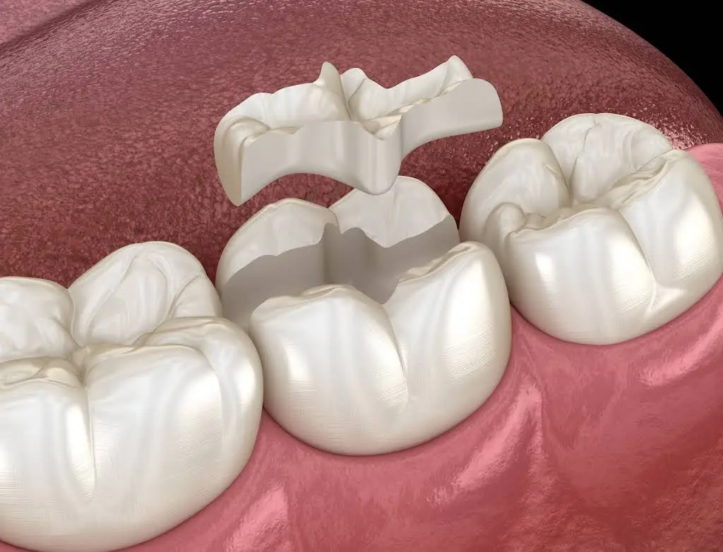 High Cosmetic Dentist