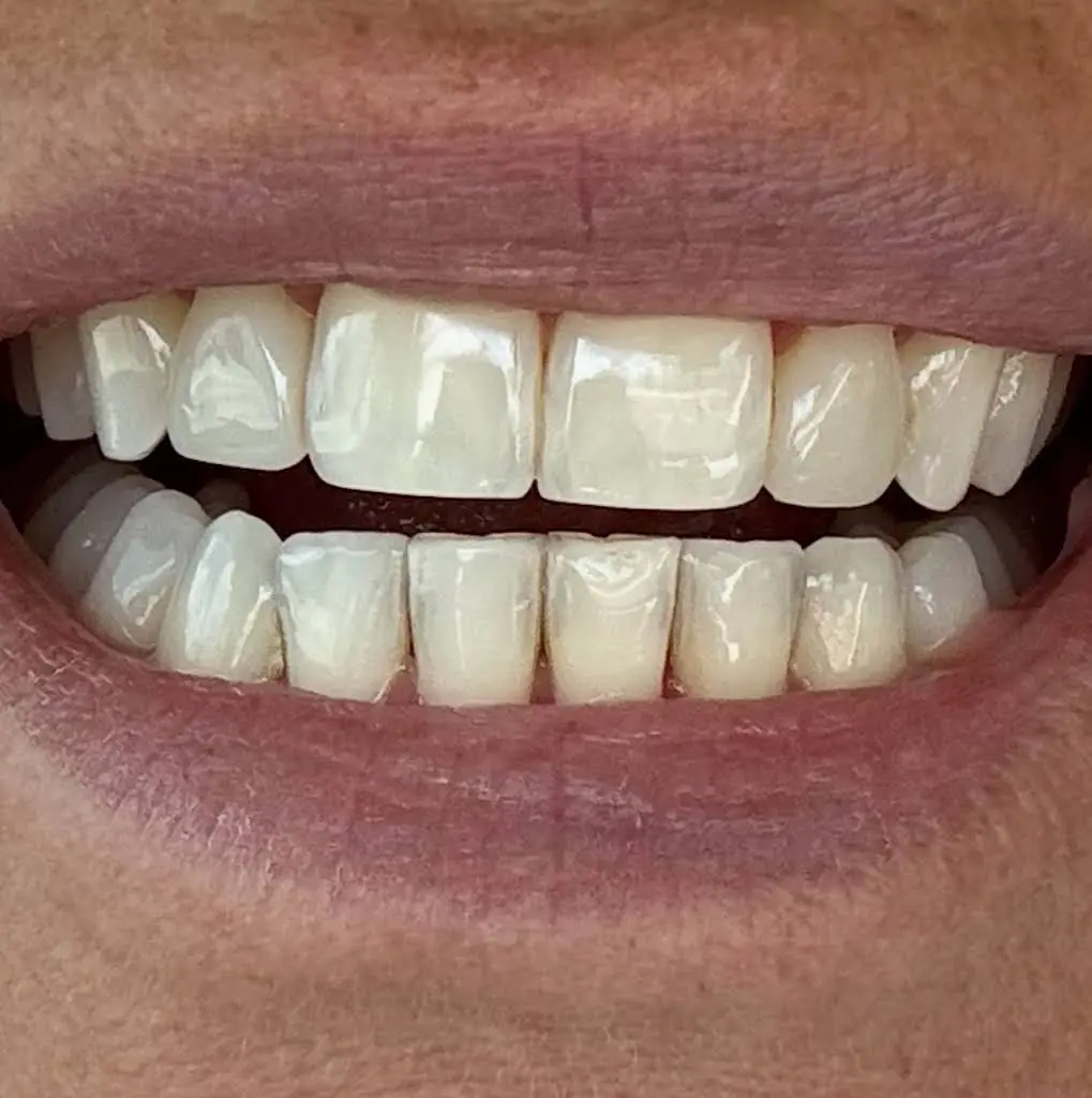 My Smile Miami