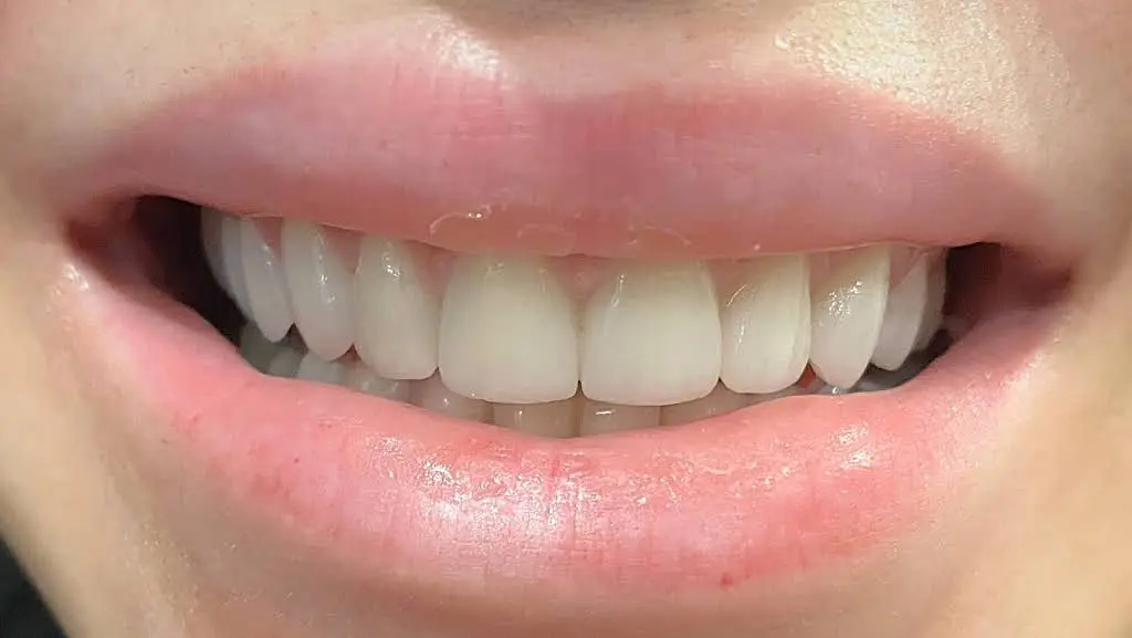 My Smile Miami