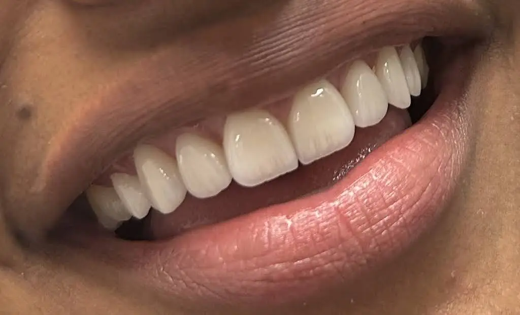 My Smile Miami