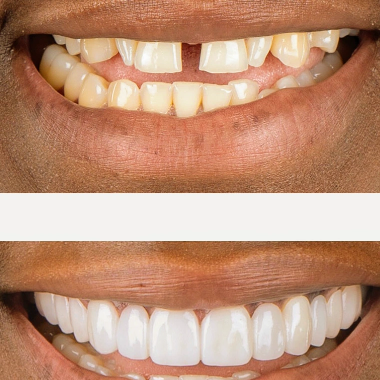 Drubi Dental