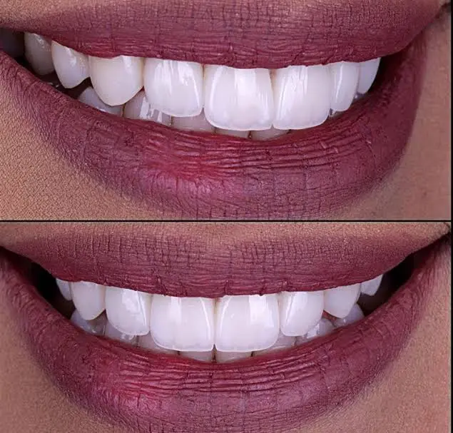Drubi Dental