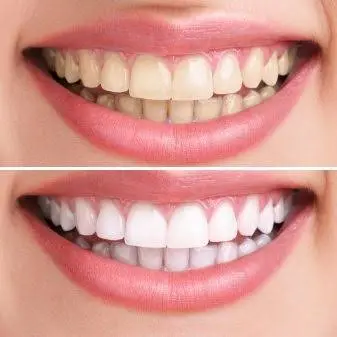 Gables Dental Care