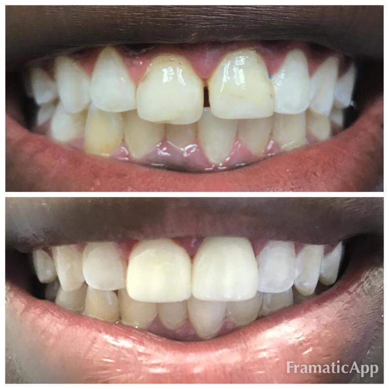 Miami Dental Group of Doral