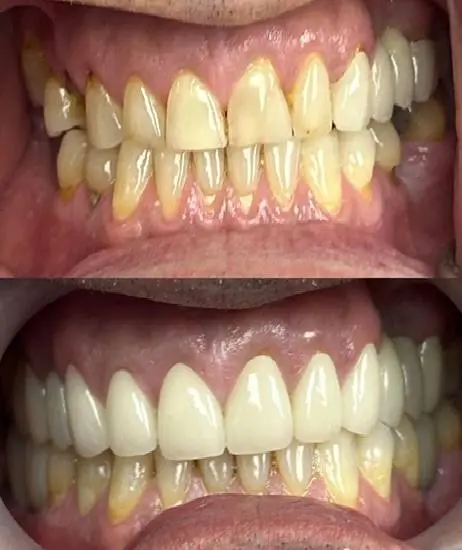 A-Z Dental