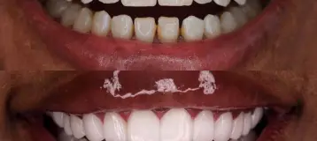 Wonder Smile By Novva Smile