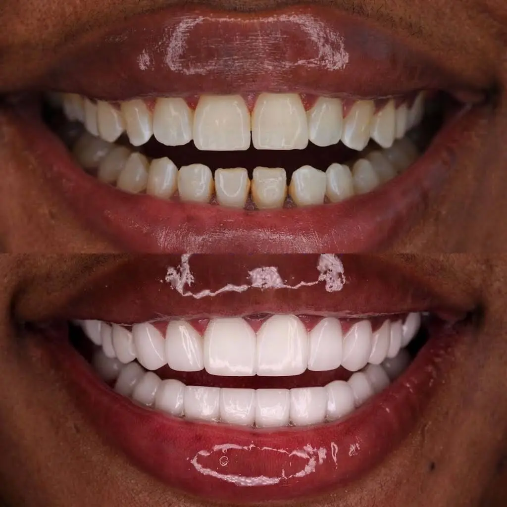 Wonder Smile By Novva Smile - Professional dental clinic exterior with modern facilities